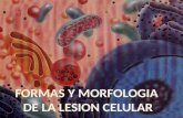Formas y morfologia d ela lesion celular