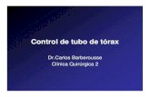 control tubo torax