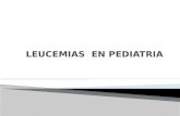 Leucemias pediatria
