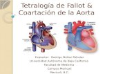 Tetralogía de Fallot & Coartación de la Aorta