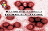Principales pruebas bioquímicas para la identificación de bacterias