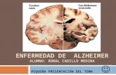 ALZHEIMER DISEASE  farmacología de neurologia