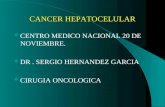 CANCER HEPATOCELULAR CENTRO MEDICO NACIONAL 20 DE NOVIEMBRE. DR. SERGIO HERNANDEZ GARCIA CIRUGIA ONCOLOGICA.