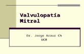 Valvulopatía Mitral Dr. Jorge Arauz ChUCR. Estenosis Mitral diástole sístole Orificio normal es de 4 a 6 cm2; tiene forma de embudo.