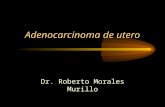Adenocarcinoma de utero Dr. Roberto Morales Murillo.