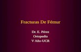 Fracturas De Fémur Dr. E. Pérez Ortopedia V Año-UCR.