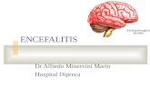 ENCEFALITIS Dr Alfredo Minervini Marìn Hospital Dipreca.