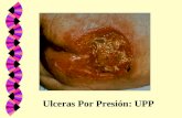 Ulceras Por Presión: UPP. UPP: Otro Gran Síndrome Geriátrico MARCADOR DE FRAGILIDAD PREDICTOR DE MORTALIDAD INDICADOR DE CALIDAD ASISTENCIAL.