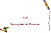 ROP Retino patia del Prematuro. ROP La retinopatía del prematuro es la primera causa de ceguera infantil en argentina. Es un trastorno en el desarrollo.