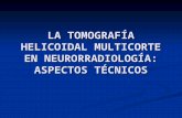 LA TOMOGRAFÍA HELICOIDAL MULTICORTE EN NEURORRADIOLOGÍA: ASPECTOS TÉCNICOS.
