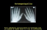 Osteopoiquilia Focos radiodensos periarticulares de morfología oval y/o redonda de tamaño entre 2 y 5 mm, de distribución simétrica.