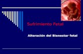 Sufrimiento Fetal Alteración del Bienestar fetal.