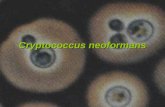 Cryptococcus neoformans. La criptococosis es una micosis sistemica causada por el diomiceto levaduriforme encapsulado C. neoformans.La criptococosis es.