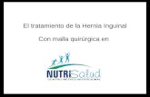 El tratamiento de la Hernia Inguinal Con malla quirúrgica en.