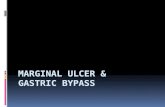 Presentation; Marginal ulcer gastric bypass