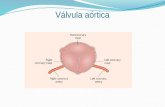 Válvula aórtica. Estenosis Aórtica Congénita > frecuente Válvula bicúspide, unicúspide o tricúspide fusionada (1 - 2%) de las cuales 30 – 50% Estenósis.