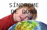 SÍNDROME DE DOWN. INTRODUCCIÓN El Síndrome de Down es un trastorno genético producido por la presencia de un cromosoma extra en la pareja cromosómica.