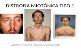 114255133-DISTROFIA-MIOTONICA (1)