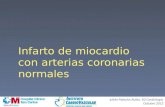 Infarto de miocardio con arterias coronarias normales Julián Palacios Rubio, R2 Cardiología Octubre 2012.