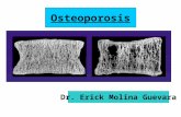 Osteoporosis Dr. Erick Molina Guevara. Tejido óseo 1.Componente mineral (65%) Calcio, fósforo, magnesio, sodio y otros 2.Matriz orgánica (33%) Colágeno.