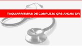 TAQUIARRITMIAS DE COMPLEJO QRS ANCHO (2ª). TV MONOFORMAS IDIOPÁTICAS - Pacientes, jóvenes (+/-), con corazones estructuralmente normales - Formas de presentación: