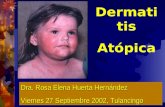 Dermatitis Atópica Dra. Rosa Elena Huerta Hernández Viernes 27 Septiembre 2002, Tulancingo.