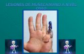 LESIONES DE MUÑECA/MANO A NIVEL OSEO. .INTRODUCCION Huesos: Entre las dos, la muñeca y la mano están compuestas de 29 huesos: diecinueve en la mano y.