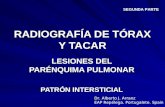 RADIOGRAFÍA DE TÓRAX Y TACAR. PATRÓN INTERSTICIAL. PARTE 2