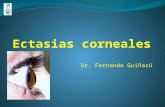 Dr. Fernando Guiñazú. Ectasias mas frecuentesEctasias mas frecuentes Queratocono Degeneracion marginal pelúcida Queratoglobo Ectasias post quirúrgicas.