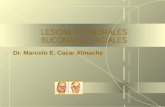 18/03/10 LESIONES TUMORALES BUCOMAXILOFACIALES Dr. Marcelo E. Cazar Almache.
