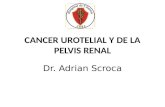 CANCER UROTELIAL Y DE LA PELVIS RENAL Dr. Adrian Scroca.