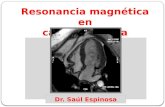 Resonancia magnética en cardiomiopatía Dr. Saúl Espinosa.
