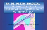 RM DE PLEXO BRAQUIAL : VALORACIÓN DE LA PLEXOPATÍA TRAUMÁTICA Y NO TRAUMÁTICA. Hospital Universitario Son Dureta. Palma de Mallorca.