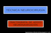 TÉCNICA NEUROCIRUGÍA TRACTOGRAFÍA DE APOYO NEURONAVEGACIÓN Agradecimientos al Servicio de Neurocirugía H. U. La Fe.