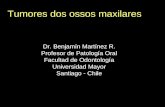 Tumores dos ossos maxilares Dr. Benjamín Martínez R. Profesor de Patología Oral Facultad de Odontología Universidad Mayor Santiago - Chile.