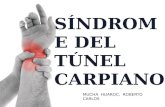 Tunel Carpiano