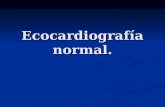 Ecocardiografía normal.. Eco bidimencional: Vistas ortogonales: Plano de eje corto Plano del Eje largo Plano de Las 4 Camaras.