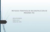 METODOS ITERATIVOS DE RECONSTRUCCIÓN DE IMAGENES TAC