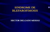 SINDROME DE BLEFAROFIMOSIS