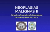 Neoplasias malignas 1