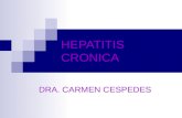 Hepatitis cronica