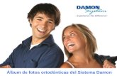 Damon - Ortodoncia revolucionaria
