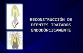 Reconstrucción dte tratado endodónticamente luz 2009
