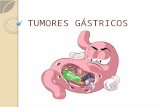 Tumores gástricos. upv