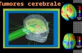 Modelo de presentacion de tumores cerebrales