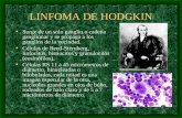 Linfoma de hodgkin(2)