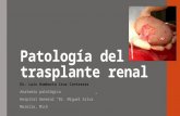 Patología del trasplante renal