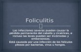 32 foliculitis