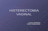 Histerectomia Vaginal