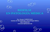Biofilm en patología médica